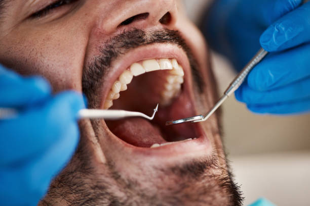 Best Emergency Treatment for Oral Infections in Spanay, WA